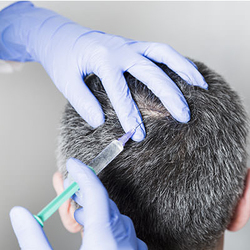 Виды мезотерапии и препараты для лечения волос